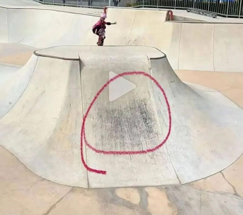  广州滑板场地事故频发隐患；男孩重伤后家长维权，协议效力备受争议。 新闻